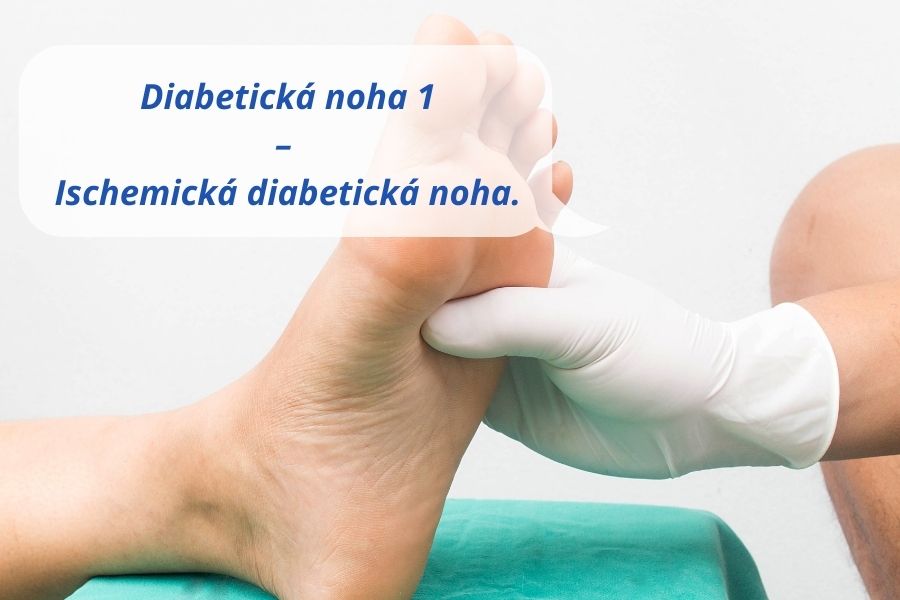 ischemická diabetická noha