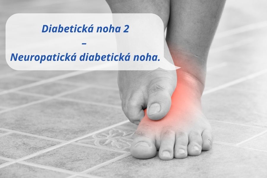 Neuropatická diabetická noha