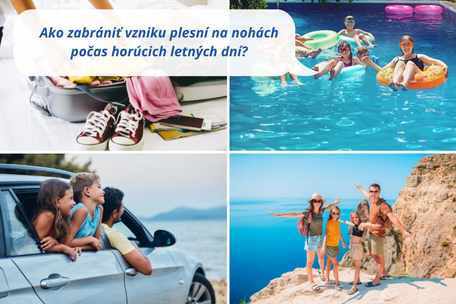 Leto bez plesni nôh - ako na to?