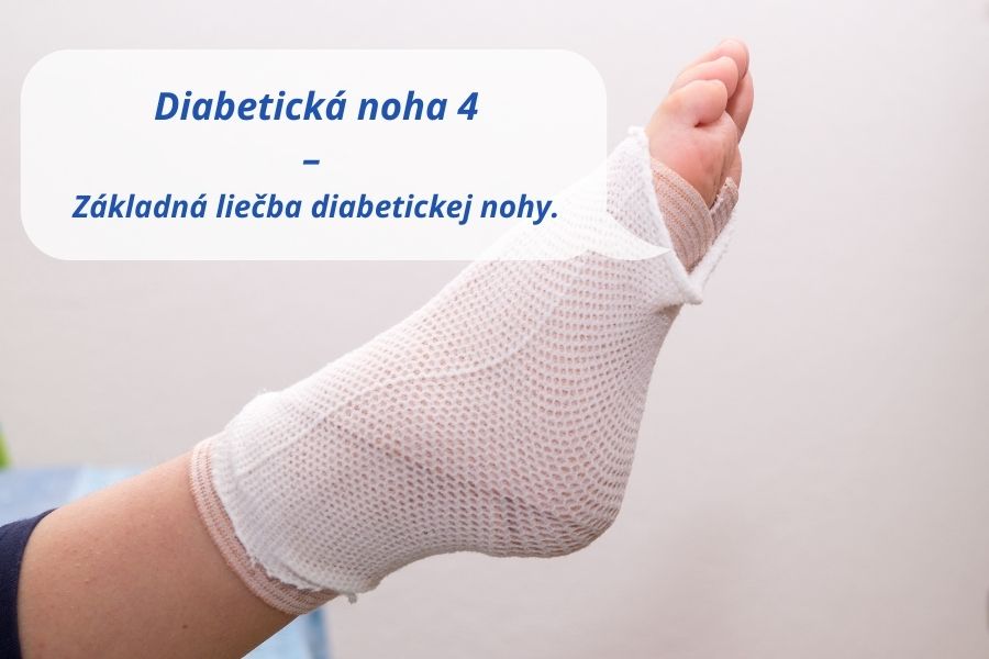 Základná liečba diabetickej nohy