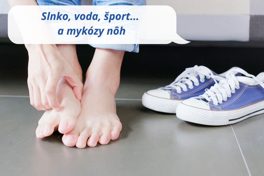 Atletická noha, pleseň na nohe - ako sa brániť a účinne liečiť?