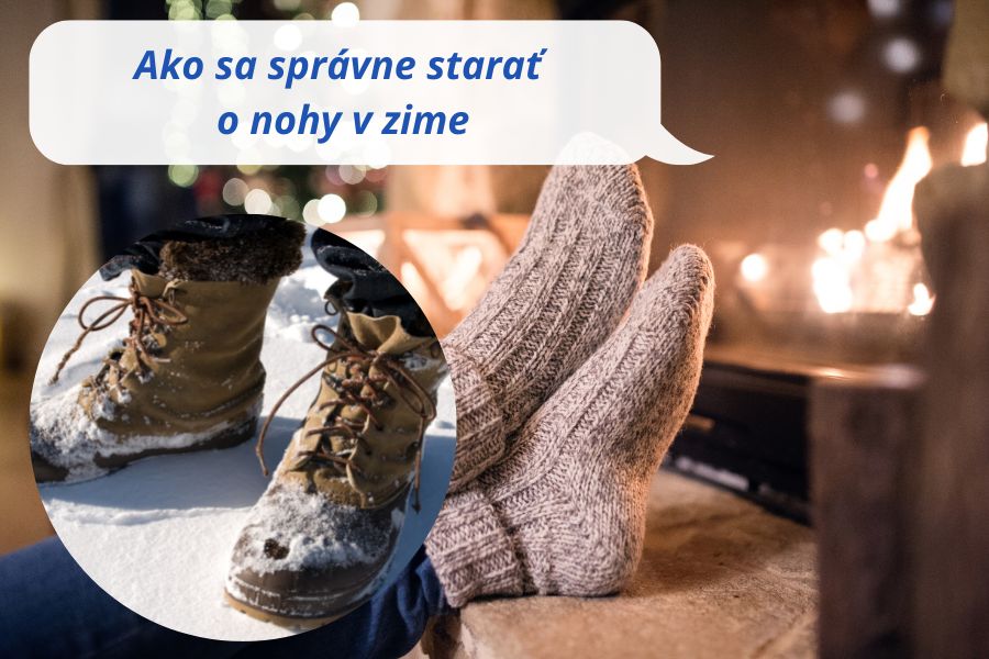 Starostlivosť o nohy v zime. Ako ich mať ako v bavlnke?