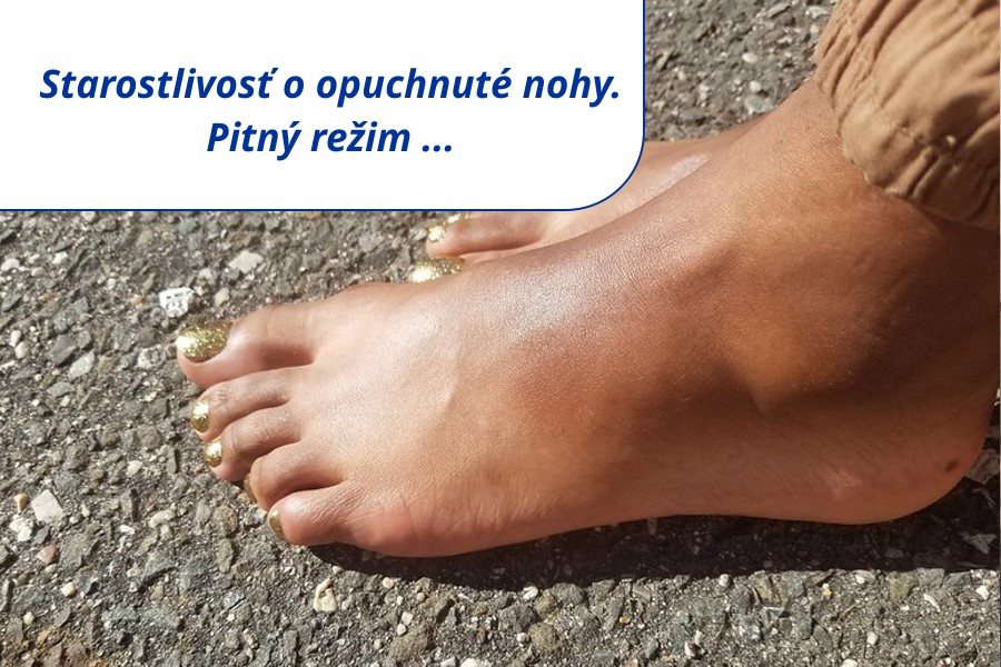 Starostlivosť o opuchnuté nohy – pitný režim