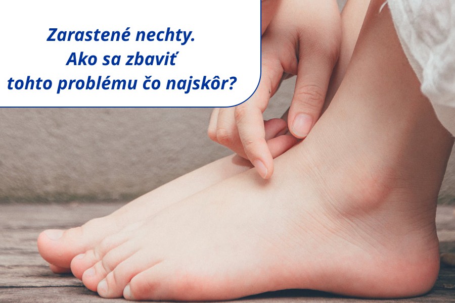 Zarastené nechty - ako sa zbaviť tohto problému